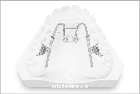 Distal slider 01@2x 80 12d4abff
