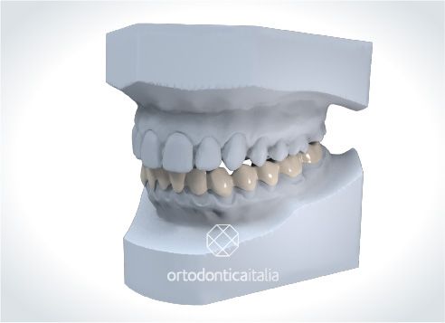 Ortotico 1@2x 80 6e720971