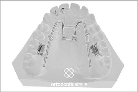 Mesiadistal 01@2x 80 eb9d96ae