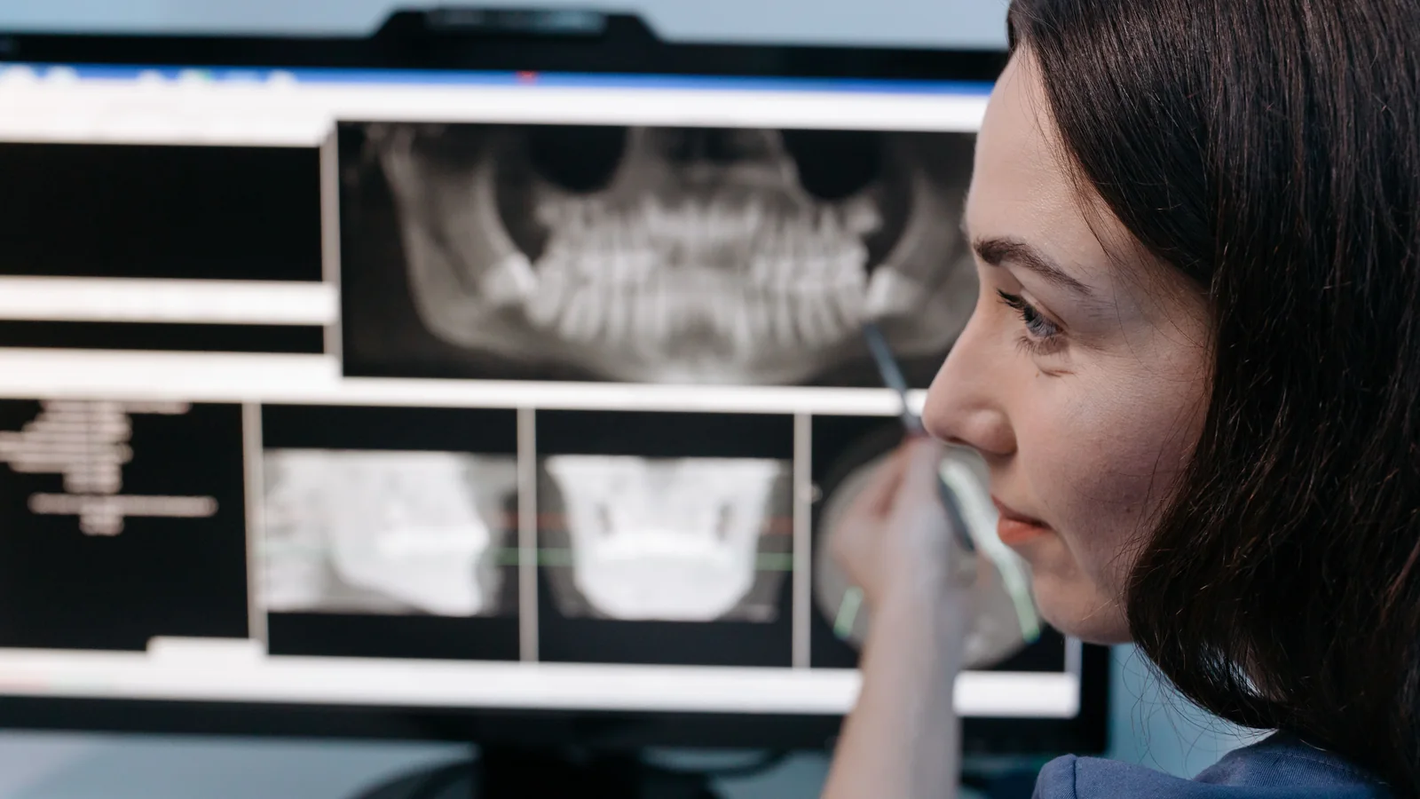 Intelligenza artificiale in ortodonzia: applicazioni concrete, limiti e competenze del clinico